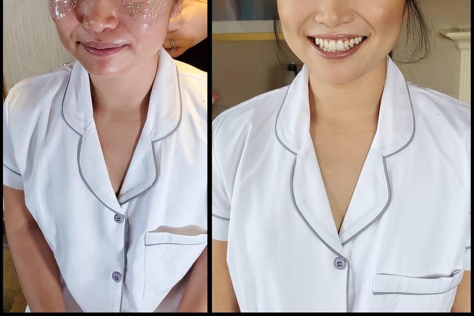 Before & After (natural)