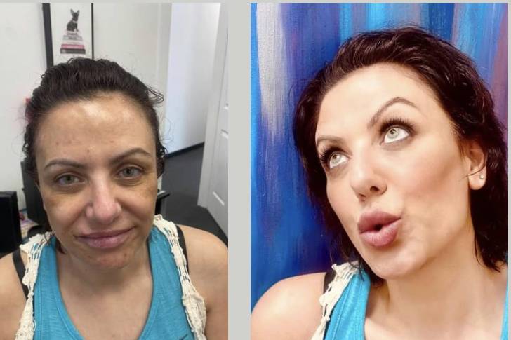 Before and after