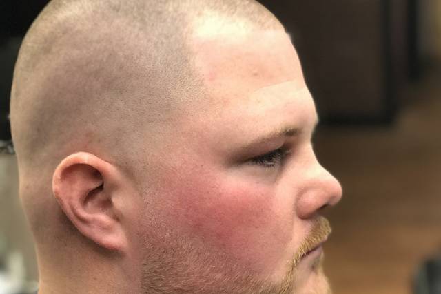 High and tight skin