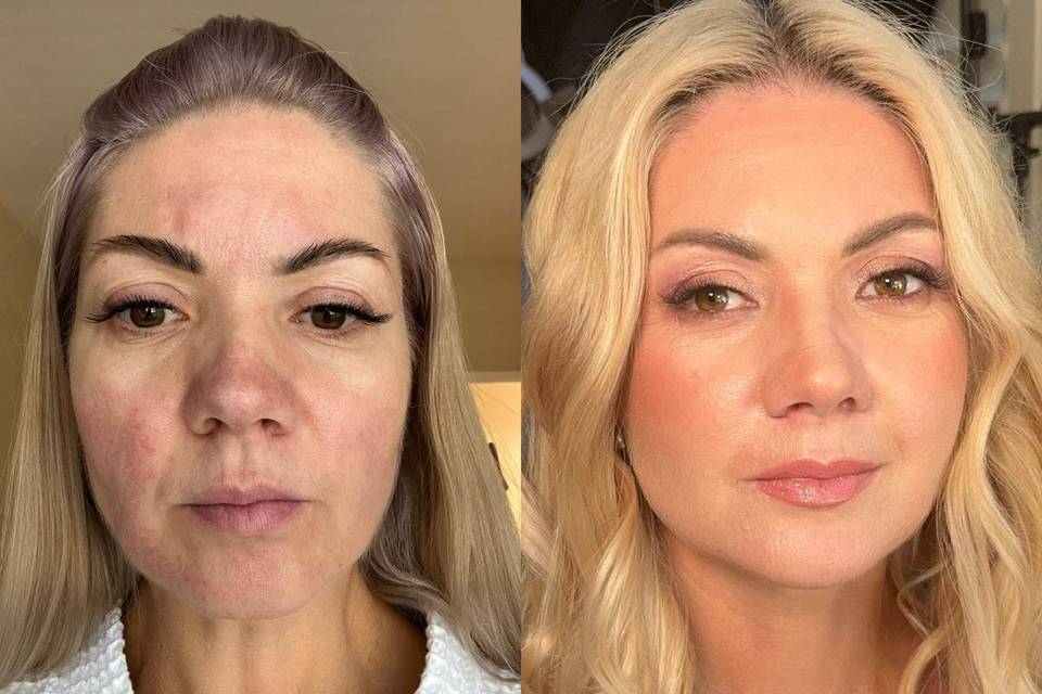 Makeup with rozacea