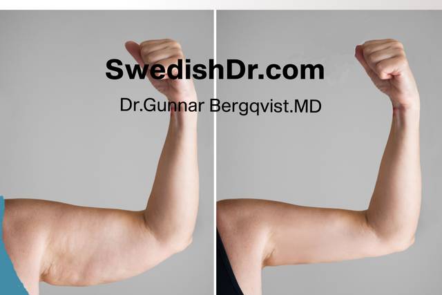 Need pretty arms?