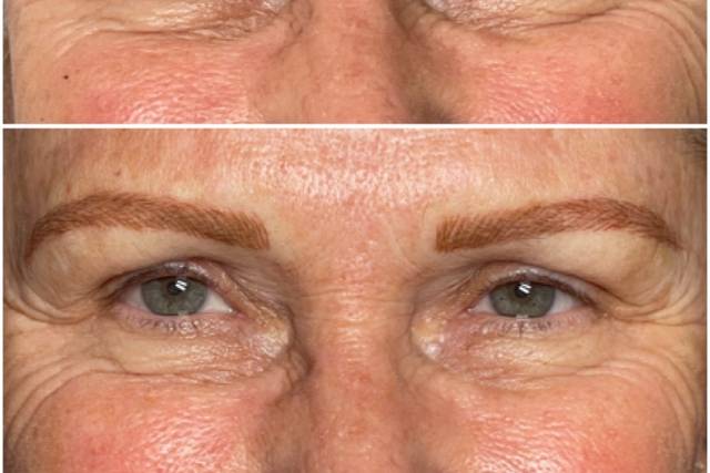 Microblading