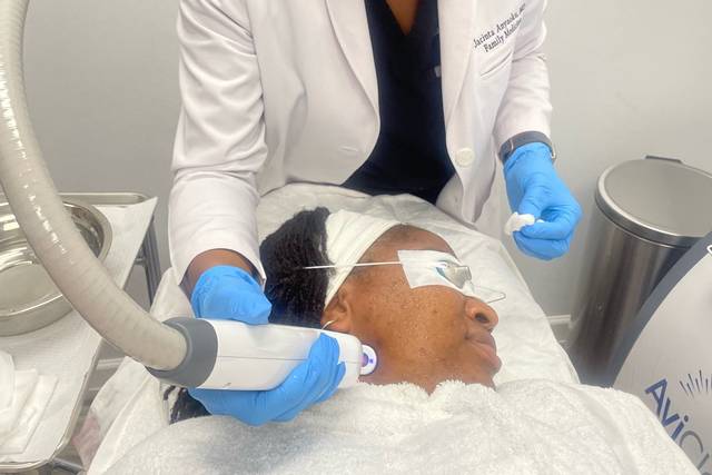 Acne laser