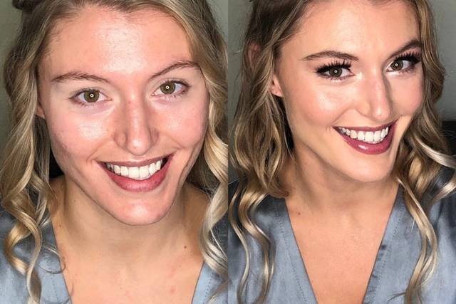 Before and After