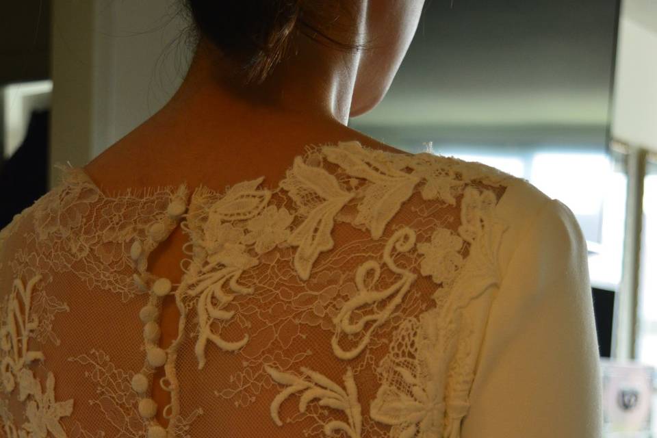 Back alteration