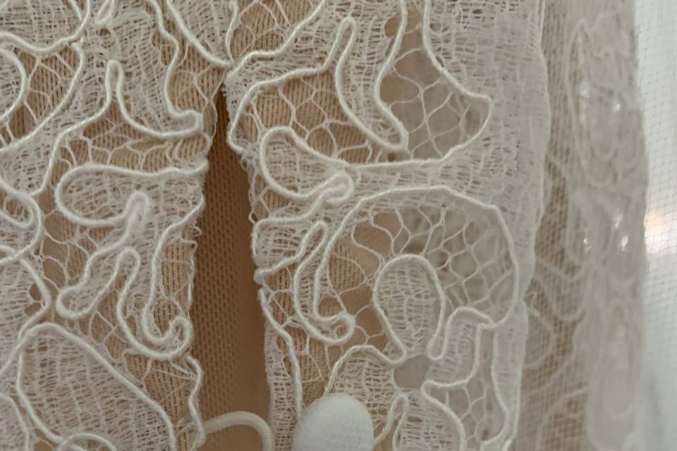 Lace button