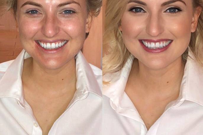 Bride Before and After