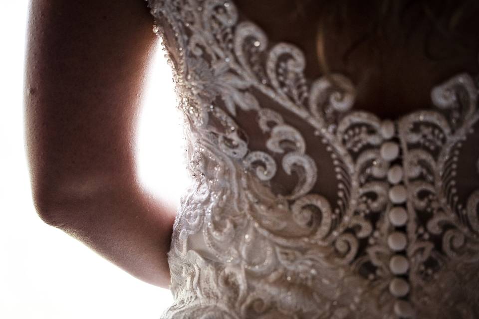 Dress details