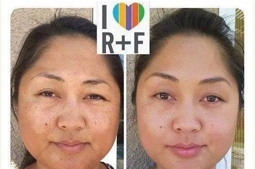 Rodan + Fields Executive Consultant