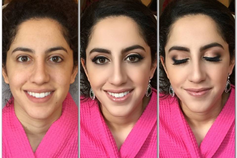 Before and After