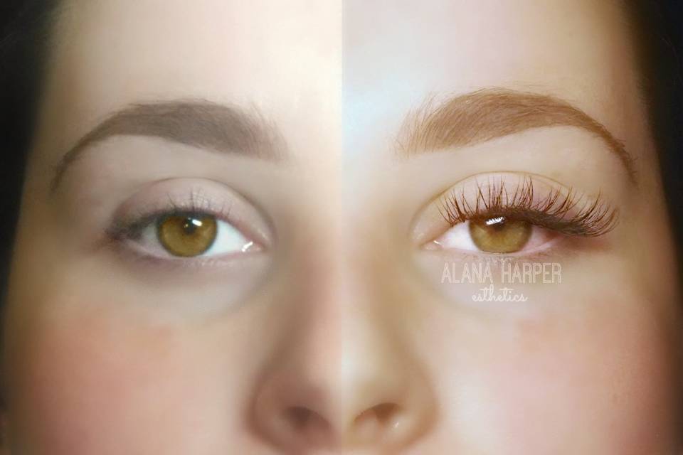 Alana Harper Esthetics