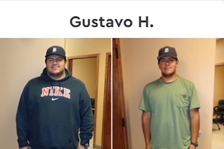 Gustavo Before & After