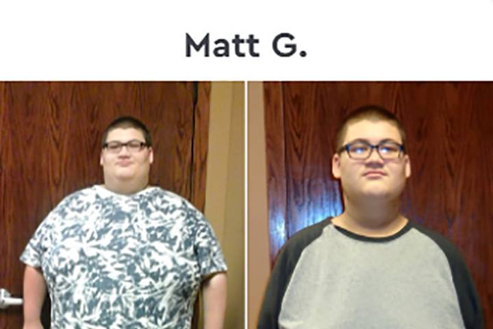 Matt Before & After