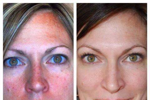 She restored the moisture balance of her skin, and evened her complexion.