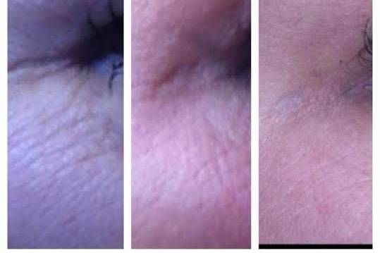 Our eye cream is wonderful!