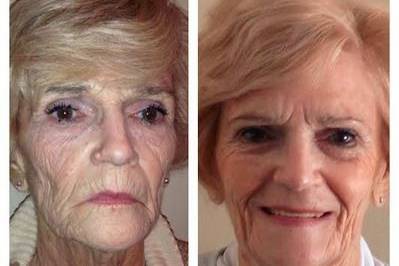 For the grandmother of the bride or groom...? Our products work wonders, even for those who are at an advanced age. this woman rejuvenated her skin using our product line.