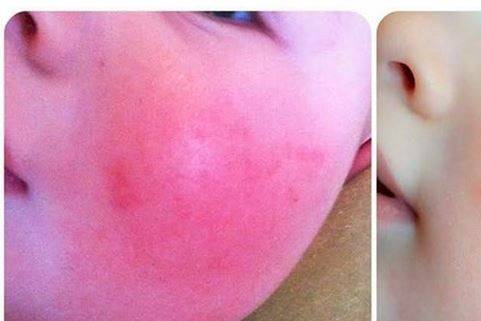 Our products work for young and old, and those with the most sensitive skin.