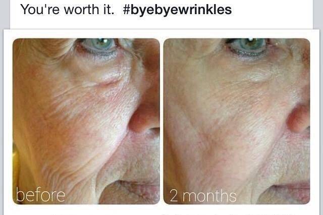 I'd say she looks refreshed!