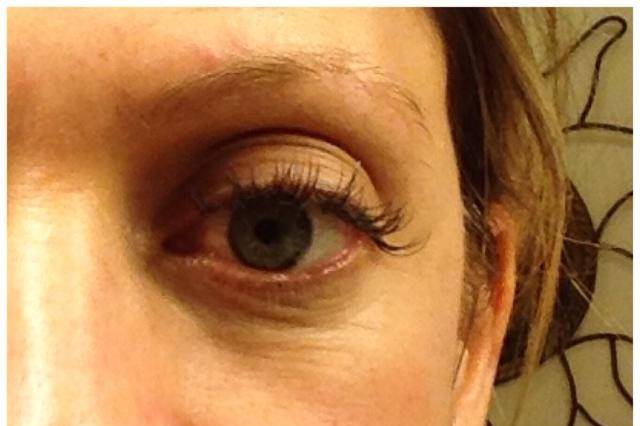 I can help you fill in sagging eye area without the high cost or pain of injections. Topical patch will do the trick.
These are Jen's 30 day results.
