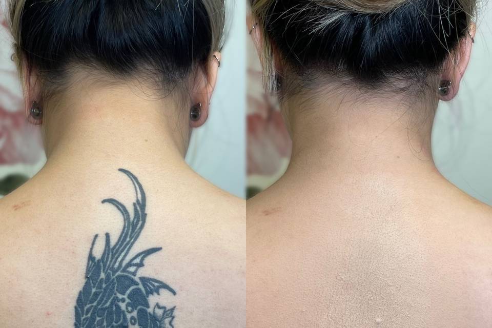 Tattoo Cover Up