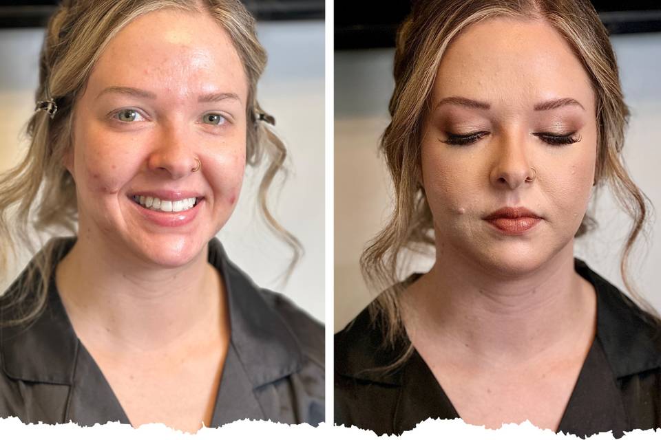 Acne covered makeup