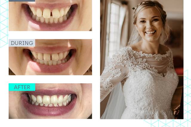 Wedding makeover 1
