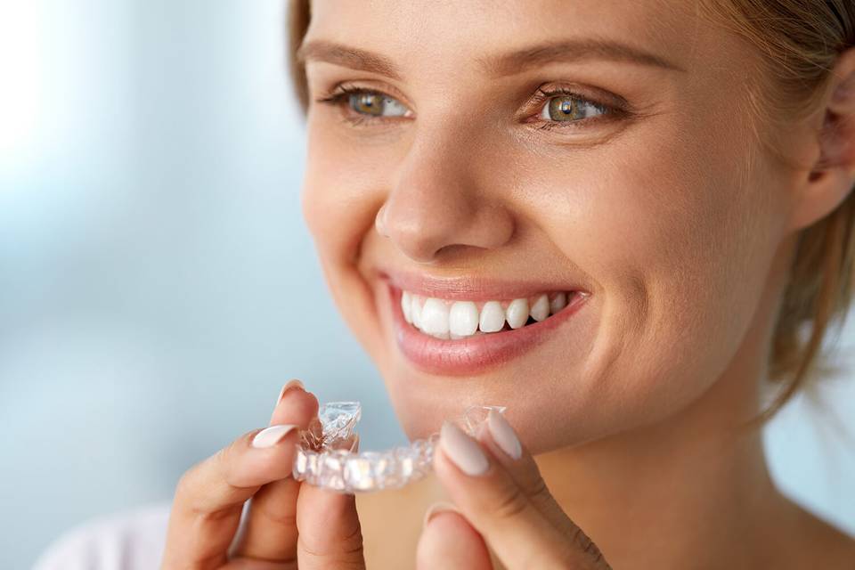 Clear Aligners