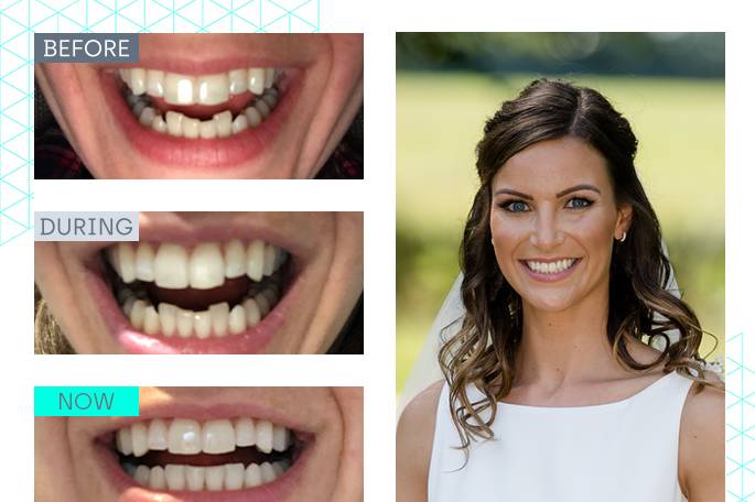 Wedding makeover 2