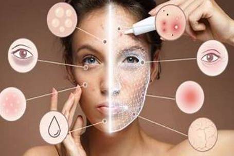 Skin Analysis