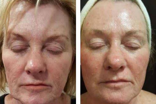 Before & After