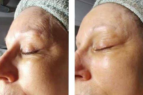 Before & After