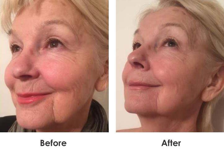 Before & After