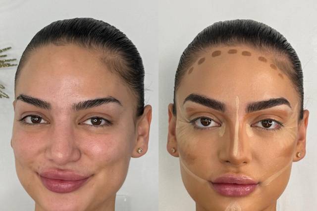Before & After