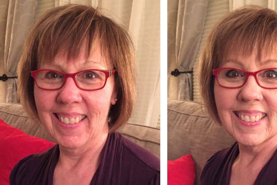 Before and after result