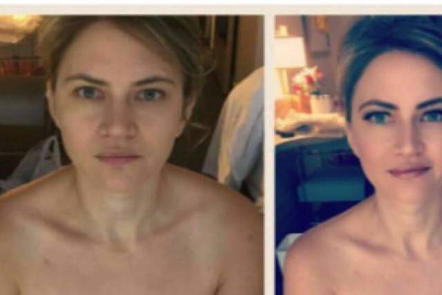 Before and after