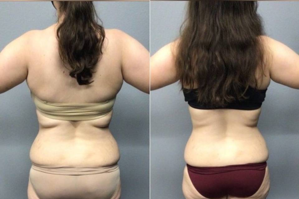 Balanced Body Weight Loss & Wellness