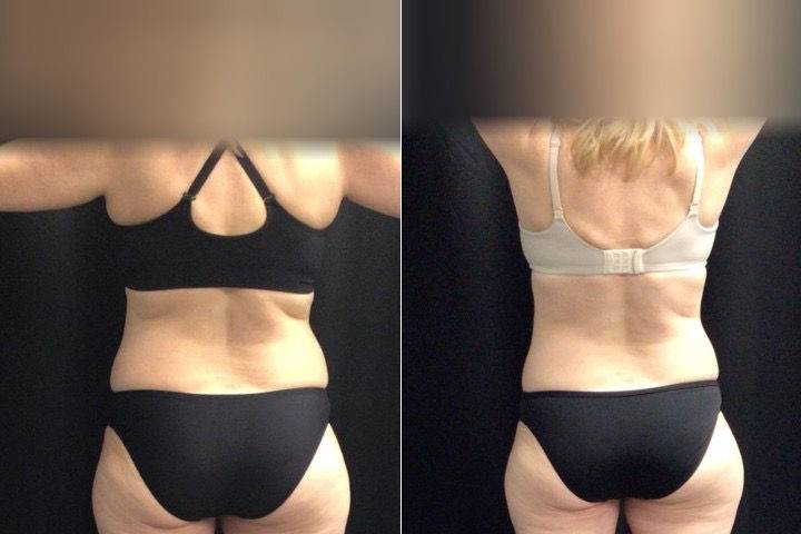 Balanced Body Weight Loss & Wellness