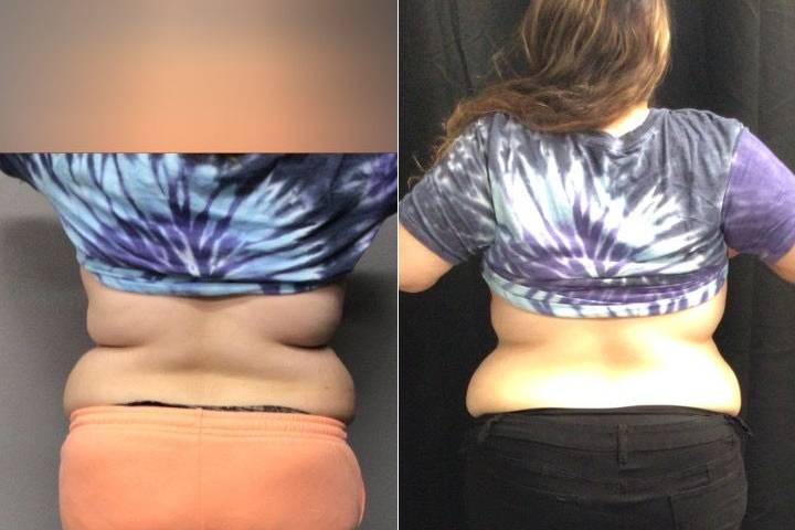 Balanced Body Weight Loss & Wellness
