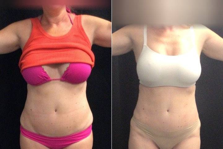 Balanced Body Weight Loss & Wellness