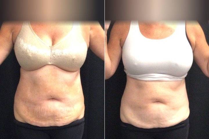 Balanced Body Weight Loss & Wellness