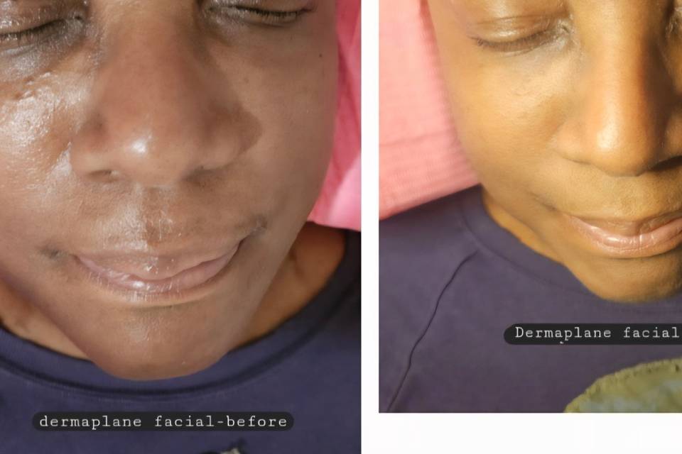 Eyebrow shaping and face care