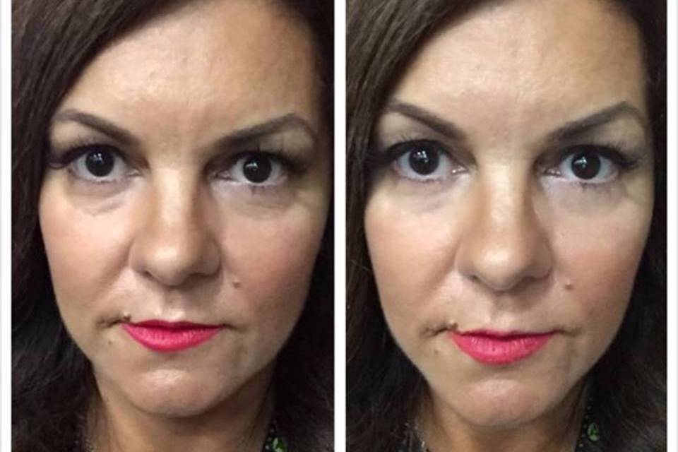 Wow! Our new product to wipe out wrinkles! And make you say wow! These results are in 90 seconds!