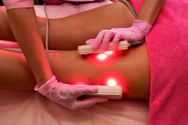Laser Lipo