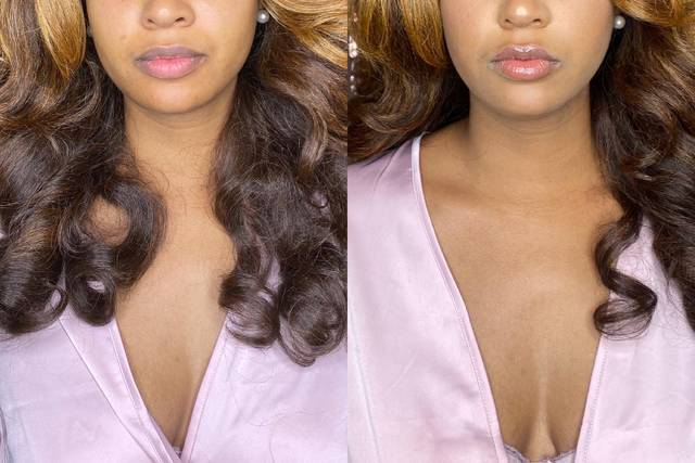 Before & After