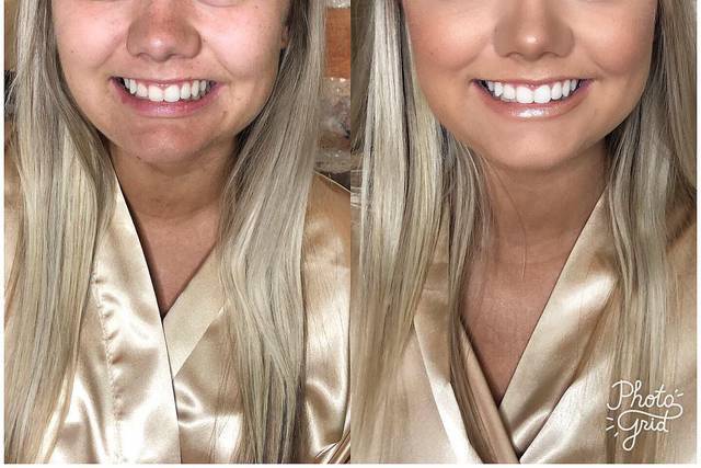 Before and after