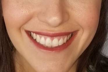 Eyes and lips