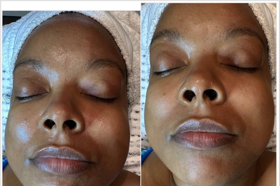 Before & After