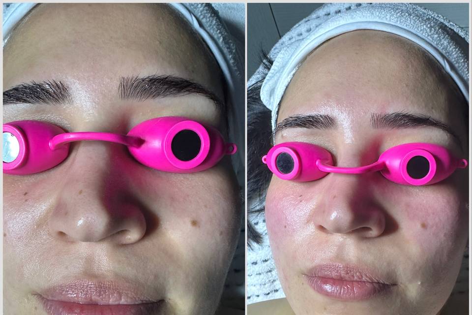 Before & After