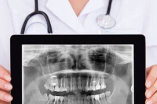 X-ray