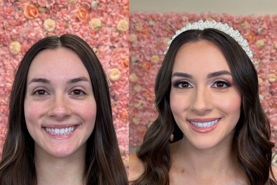 Before and after
